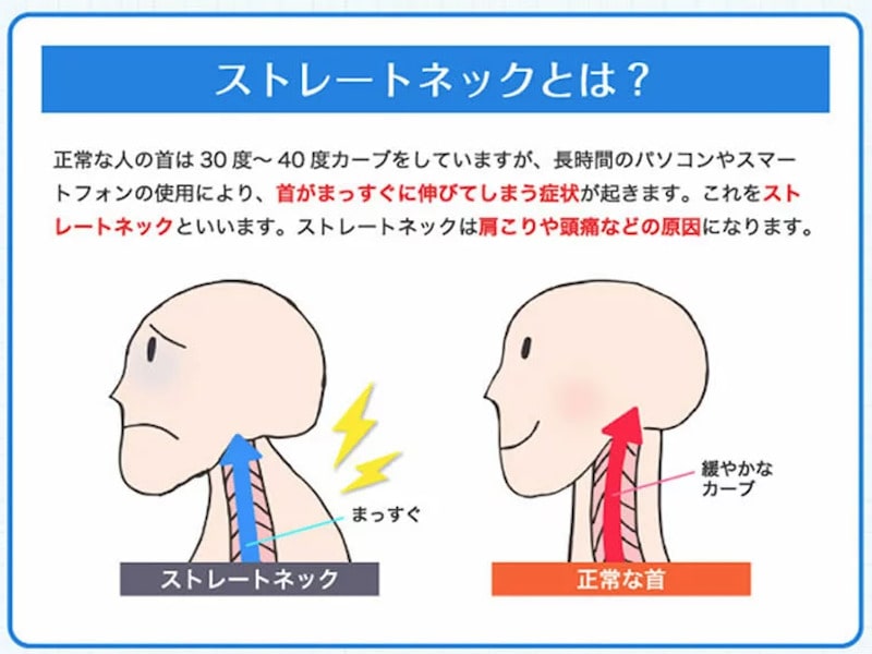 ストレートネック