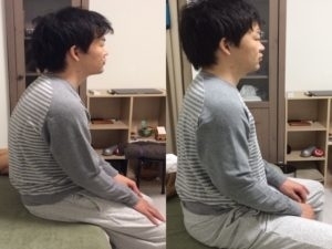 猫背