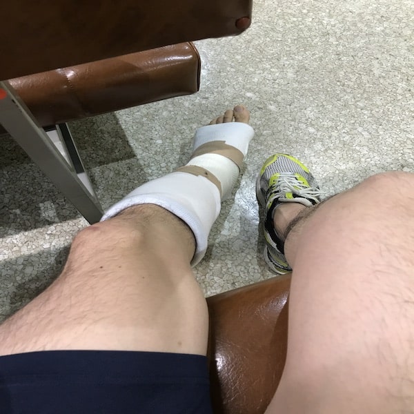 怪我してギブスをした